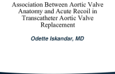 TCT 562: Association Between Aortic Valve Anatomy and Acute Recoil in Transcatheter Aortic Valve Replacement