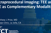 Intraprocedural Imaging: TEE and ICE as Complementary Modalities