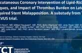 TCT 503: Percutaneous Coronary Intervention of Lipid-Rich Plaques and Impact of Thrombus Burden on Late Acquired Stent Malapposition: A Substudy From the NIRVUS Trial