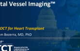 Full Vessel Imaging