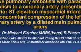 TCT 1027: Massive pulmonary embolism With Paradoxical Embolism to a Coronary Artery Presenting as InferiorSTEMI, With Concomitant Compression of the Left Main Coronary Artery By Dilated Main Pulmonary Artery