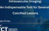 Intravascular Imaging: An Indispensable Tool for Severely Calcified Lesions