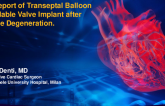 TCT 971:  First Report of Transeptal Ballon Expandable Valve Implant after Tendyne Degeneration.
