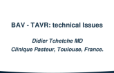 SPOTLIGHT LECTURE: BAV TAVR Technical Issues - Valve Choice and Sizing, Implant Strategy, and Coronary Access