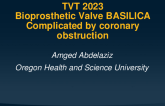 BASILICA complicated by coronary obstruction